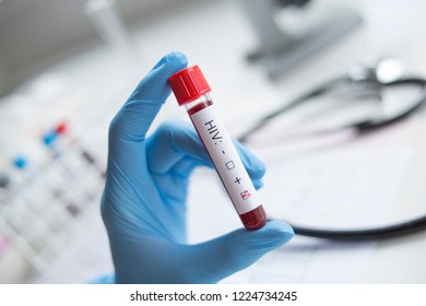 Diagnostician Holding In Hand A Positive HIV Test.