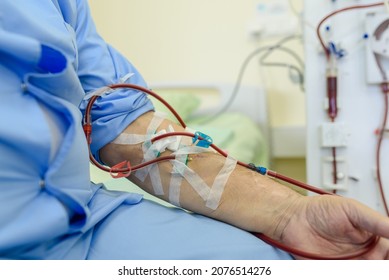 dialysis catheter connected to a vein in a hospital 