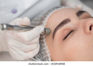 Diamantmikrodermabrasion, kosmetisches Peeling. Frau während einer Behandlung mit Mikrodermabrasionen im Schönheitssalon