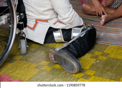 
Diasabled Man Sitting On The Floor With Old Polio Knee Caliper Brace, Next To Wheelchair And Other People
