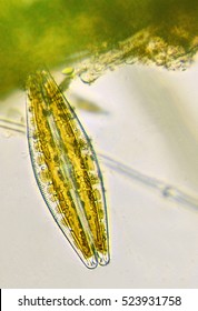 Diatom 