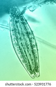 Diatom 