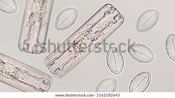 Diatoms, algae under microscopic\
view, phytoplankton, fossils, silica, golden yellow\
algae