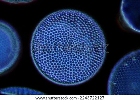 diatoms, dark-field microscopy, unicellular organism, algae