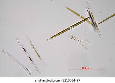 Diatoms In Fresh Water  Under Optical Microscope