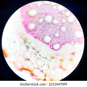 Dicotyledon And Monocotyledon Plant Cross Section 