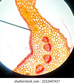 Dicotyledon And Monocotyledon Plant Cross Section 