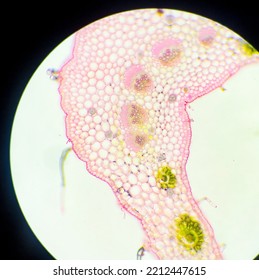 Dicotyledon And Monocotyledon Plant Cross Section 