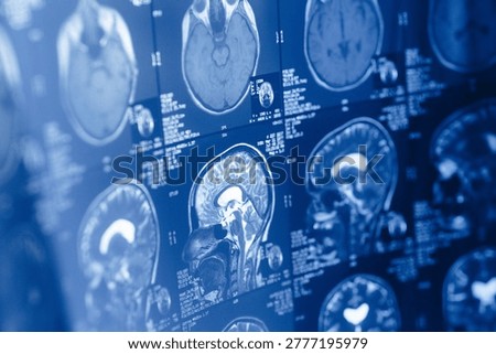 Different brain scans are displayed on screens for doctors and health professionals to study brain activities and conditions. The scans are part of a diagnostic procedure in a hospital.