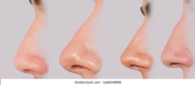 different nose shapes close