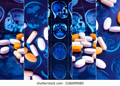 Different Pharmaceutical Medicine Pills On Magnetic Brain Resonance Scan Mri Background Collage. Pharmacy Theme, Health Care, Drug Prescription For Tumor, Alzheimer, Mental Illness Treatment