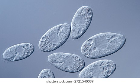 Differential interference contrast (DIC) micrograph of a group of freshwater ciliates at 400x magnification, showing cilia, nuclei, and food vacuoles. Captured from a freshwater sample using an Olympus Vanox AHBT3 microscope