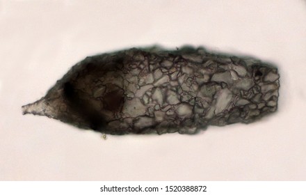 Difllugia Test Made By A Single Cell From Fragments Of Grit. The Amoeba Lives Inside. The Shell Has A Single Opening Through Which The Amoeba Can Extend Pseudopodia To Feed And Move. Light Micrograph.