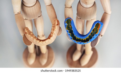 Digital Model Of The Lower Jaw And A Silica Impression In The Hands Of Wooden Men, Top View On A White Background