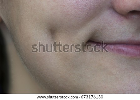 Dimple on a woman's cheek