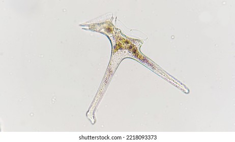 Dinophysis Miles, A Marine Phytoplankton From Dinoflagellate Group. Marine Golden AlgaeLugol-fixed Sample. 400x Magnification