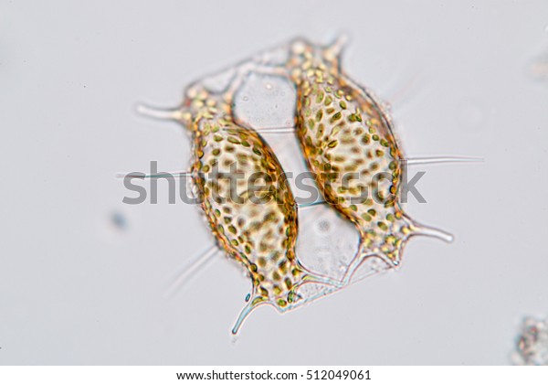 Suchen Sie Nach Dinophysis Dinoflagellat Marine Protozoa Unter Mikroskop Stockbildern In Hd Und Millionen Weiteren Lizenzfreien Stockfotos Illustrationen Und Vektorgrafiken In Der Shutterstock Kollektion Jeden Tag Werden Tausende Neue