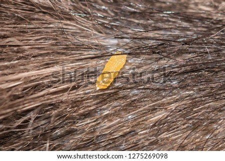 Dipylidium caninum dried gravid segments in cat's hair coat.