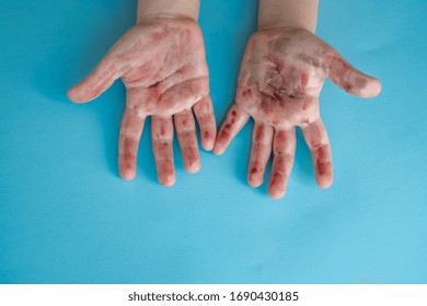 
Dirty Baby Hands On Blue Background Isolated.
