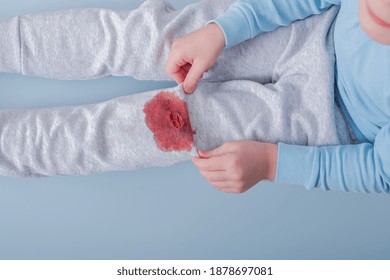 Dirty Blood Stain On Clothes. The Concept Of Cleaning Stains On Clothes. Isolated On A Blue Background