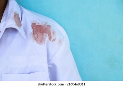 Dirty Blood Stain On Kid Shirt From Accident In Playing In Life Activity. Dirty Stain For Cleaning Concept.