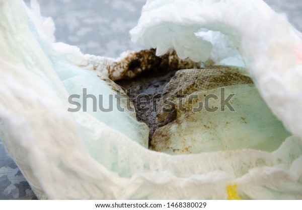 Dirty Diaper Poop On White Background Stock Photo (Edit Now) 1468380029