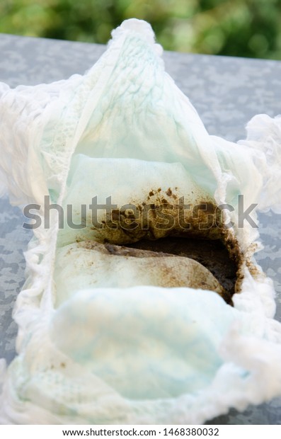 Dirty Diaper Poop On White Background Stock Photo 1468380032 