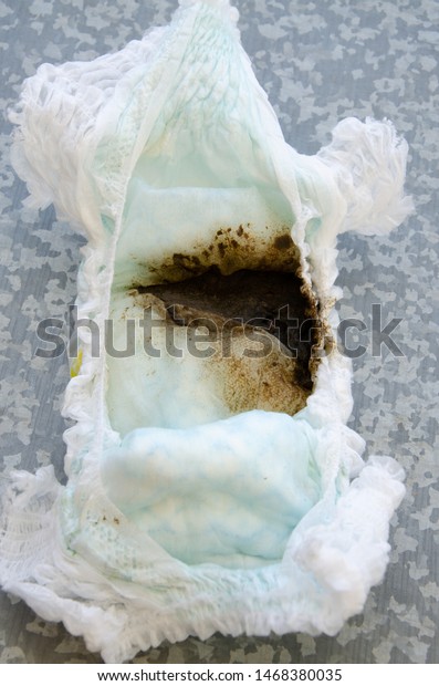 Dirty Diaper Poop On White Background Stock Photo 1468380035 | Shutterstock