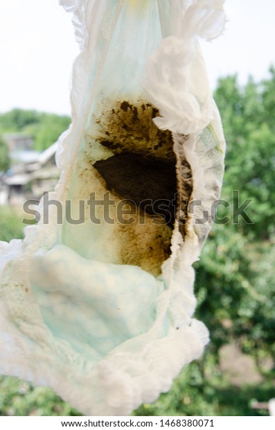 Dirty Diaper Poop On White Background Stock Photo 1468380071 | Shutterstock