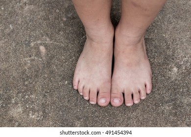 Dirty Kid's Bare Feet On Ground