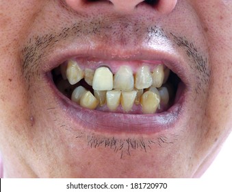 world's ugliest teeth