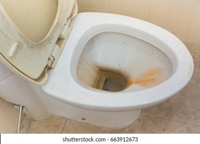 dirty toilet in apartment.