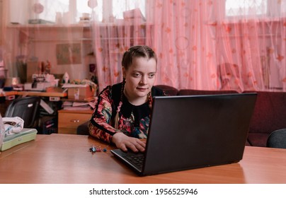 A Disabled Girl With Slanted Eyes Is Sitting At A Desk And Working On A Laptop.