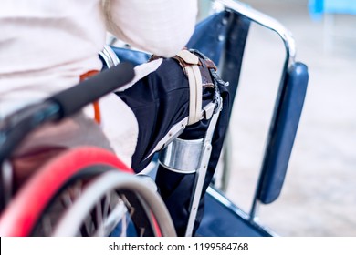 Disabled Man Sitting On The Wheelchair With Old Polio Knee Caliper Brace, Closeup View.