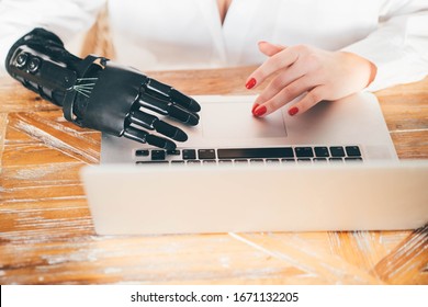 Disabled Woman Using Computer At Home.