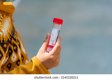 Disposable Nucleic Acid Virus Sampling Tube In Hand