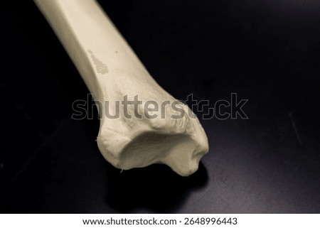 Distal Human Tibia Model View