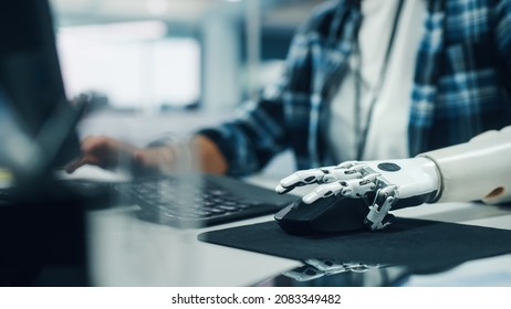 Diverse Body Positive Office: Woman With Disability Using Prosthetic Arm To Work On Computer. Professional With Futuristic Thought Controlled Myoelectric Bionic Hand.