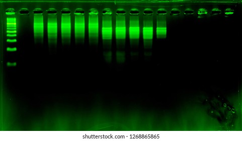 DNA Analysis By PCR-RFLP Of Apis Mellifera By Gel Electrophoresis, PCR Band Of Honey Bees, DNA Sequencing Technique.