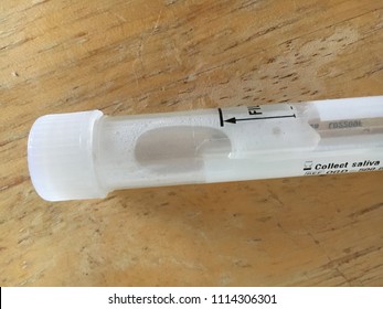 DNA Genetic Testing Saliva Kit