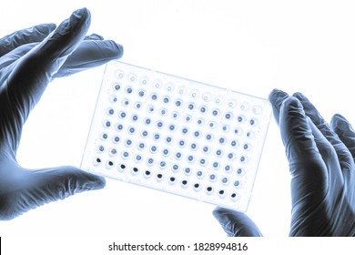 Dna Samples Are Loaded To 96-Well Plate For Pcr Analysis