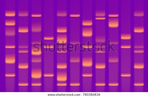 DNA Sequence Gel Close\
Up