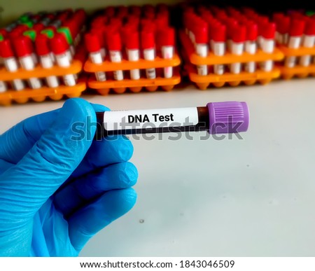DNA test. Doctor/scientist holding sample blood collection tube for DNA test in the laboratory.
