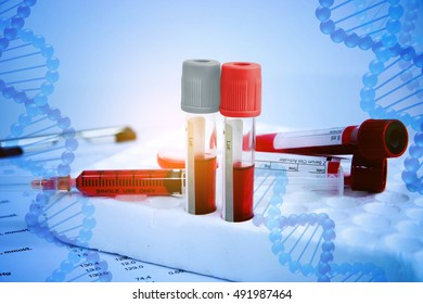 DNA testing of the blood in the laboratory with blood sample collection tubes and syringe. (blue tone)