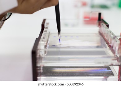 The DNA Testing, DNA Extraction In Lab