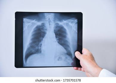 23,503 Lung X Ray Stock Photos, Images & Photography | Shutterstock