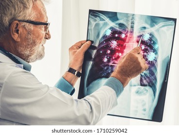 Doctor Analyze Coronavirus Disease 2019 Or Covid-19 Displayed On X Ray Film. The Film Shows Symbol Of Corona Virus Infect Patient Lung And Respiratory Organ. Medical Technology And Healthcare Concept.