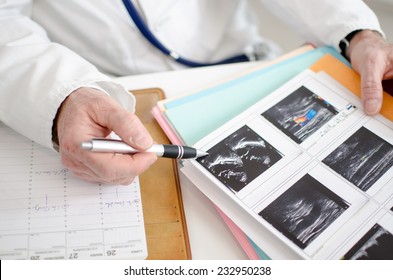 Doctor Analyzing Ultrasound Results