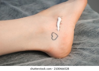 Doctor is applying cream on woman's foot with tattoo after laser removing, closeup hands in gloves. Tattoo care after the removal procedure, skin hydration.