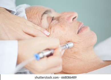 Doctor Applying A Microdermabrasion Treatment On A Senior Woman Face